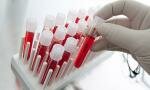 Tumori: diagnosi precoce grazie ad un esame del sangue hi-tech
