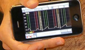 /smartphonedistanzapacemaker
