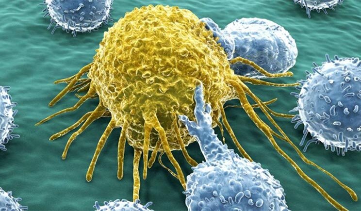 Tumori: ecco lo stop molecolare che blocca la malattia