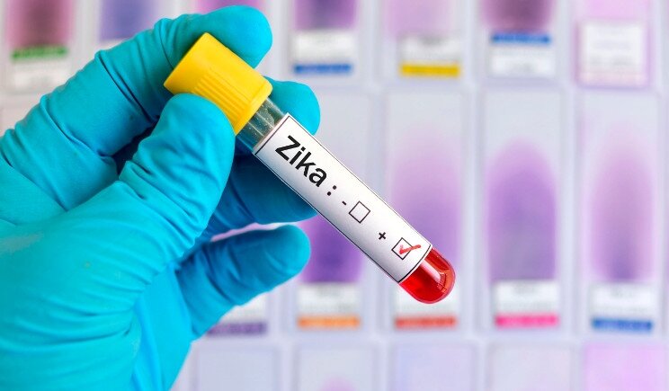 Zika: scienziati cinesi tracciano il genoma del virus