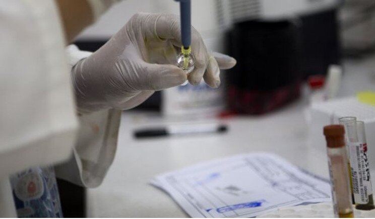 Virus Zika, studio italiano conferma il contagio per via sessuale