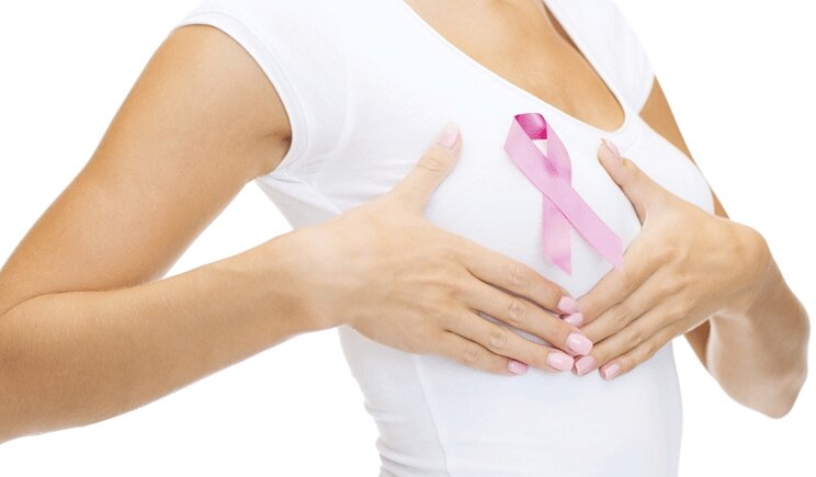 Sconfiggere il tumore al seno grazie all'oncoimmunoterapia