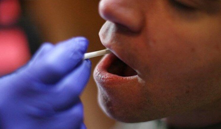 Tumori: in arrivo la diagnosi con un test della saliva