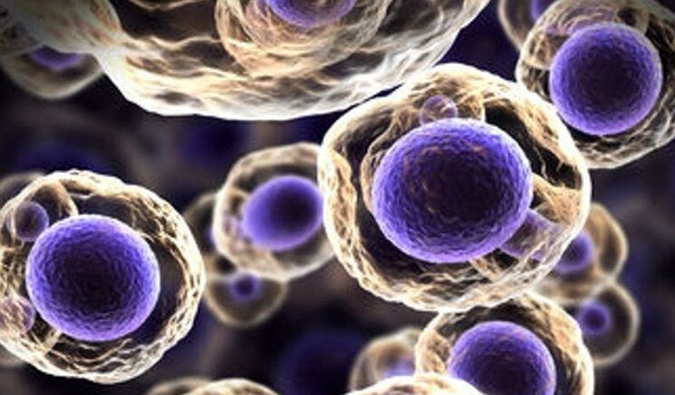 Scoperto il Tallone d'Achille del cancro: nuove speranze di guarigione