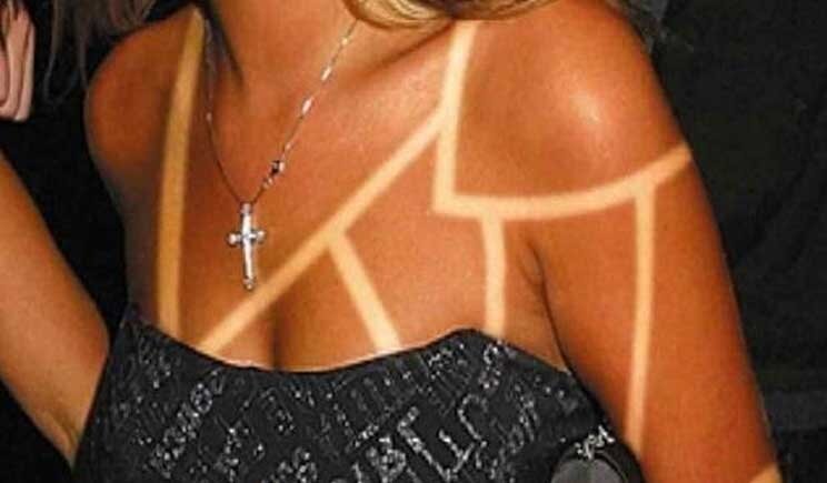 Sunburn Art: dagli Usa la pericolosa moda dei “tatuaggi solari”