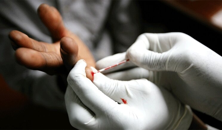 Aids: in arrivo un test “fai-da-te”