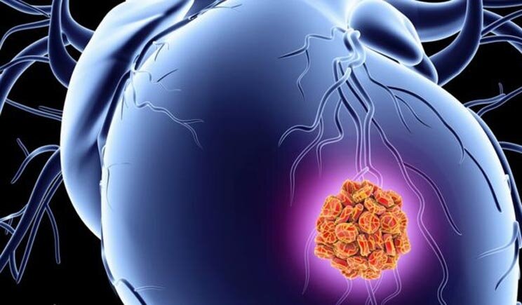 Ecco la proteina che ripara il cuore dopo un infarto