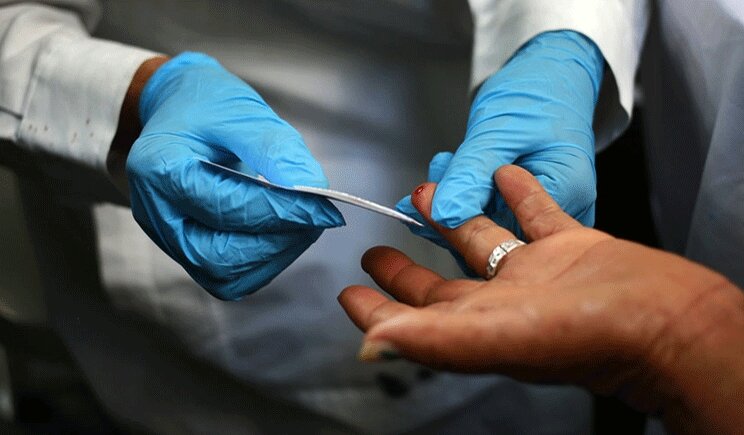 Scoprire l'età biologica grazie ad un test del sangue