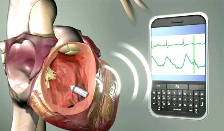 Smartphone: meglio lontano dal cuore in caso si porti un pacemaker
